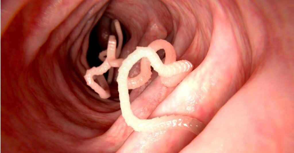Bandwürmer in einem menschlichen Darm.