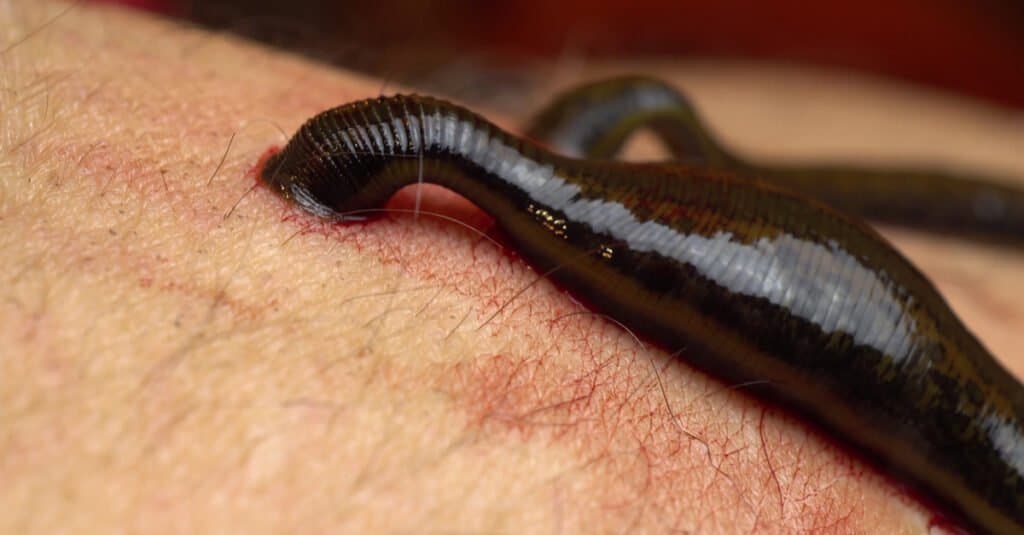 What do leeches eat - leech on human skin
