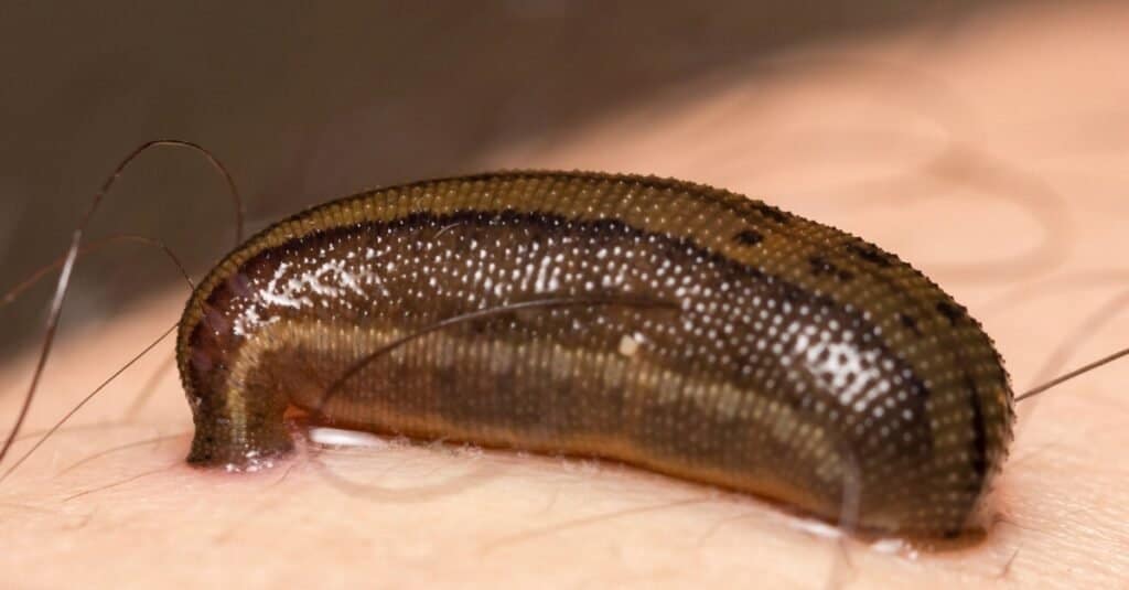 A blood-sucking leech on the human skin.