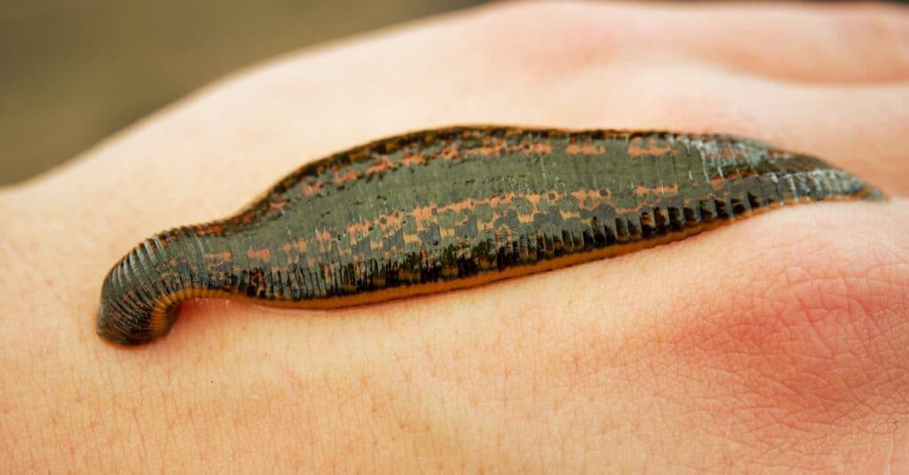 Medicinal Leech - Hirudo medicinalis - leech bite, leech is sucking blood on the human body (hand).