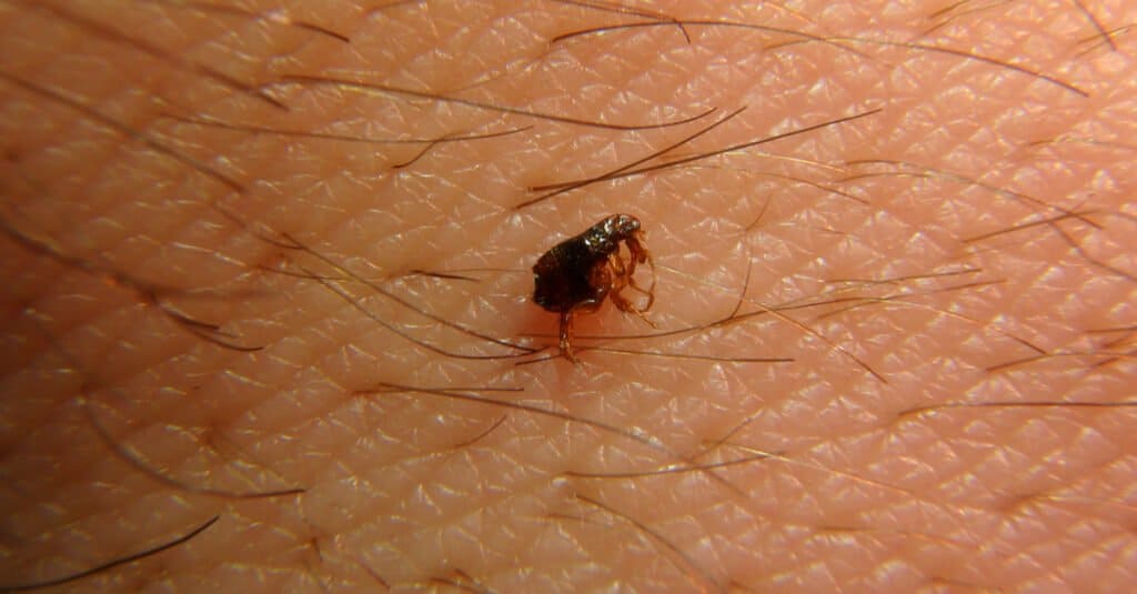 flea on human body