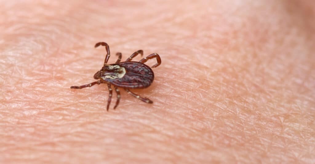 American Dog Tick (Dermacentor variabilis) on human skin.