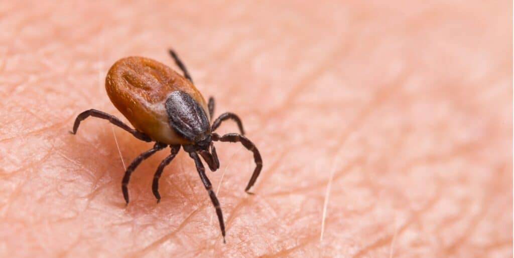 A Deer tick, a parasitic biting insect on background of human epidermis.