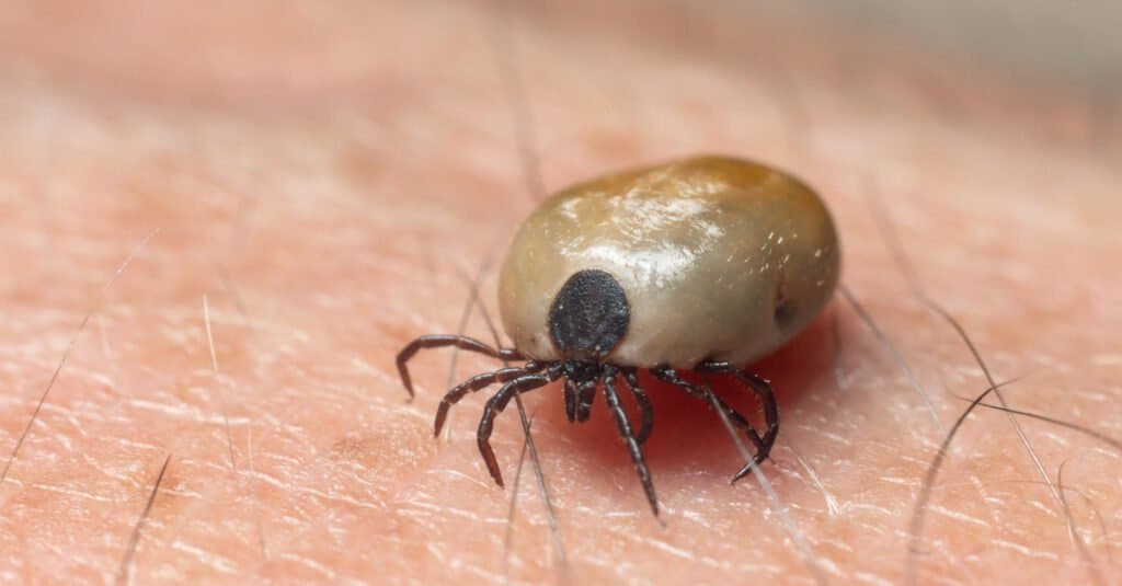 A Dog tick drunk on blood crawls on human skin.