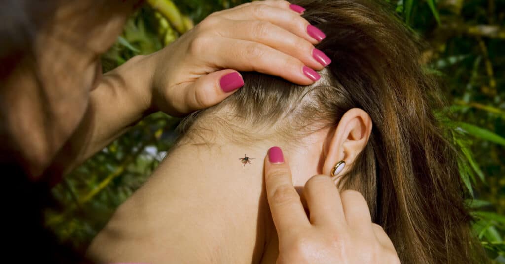 People looking at a wood tick embedded in human skin.