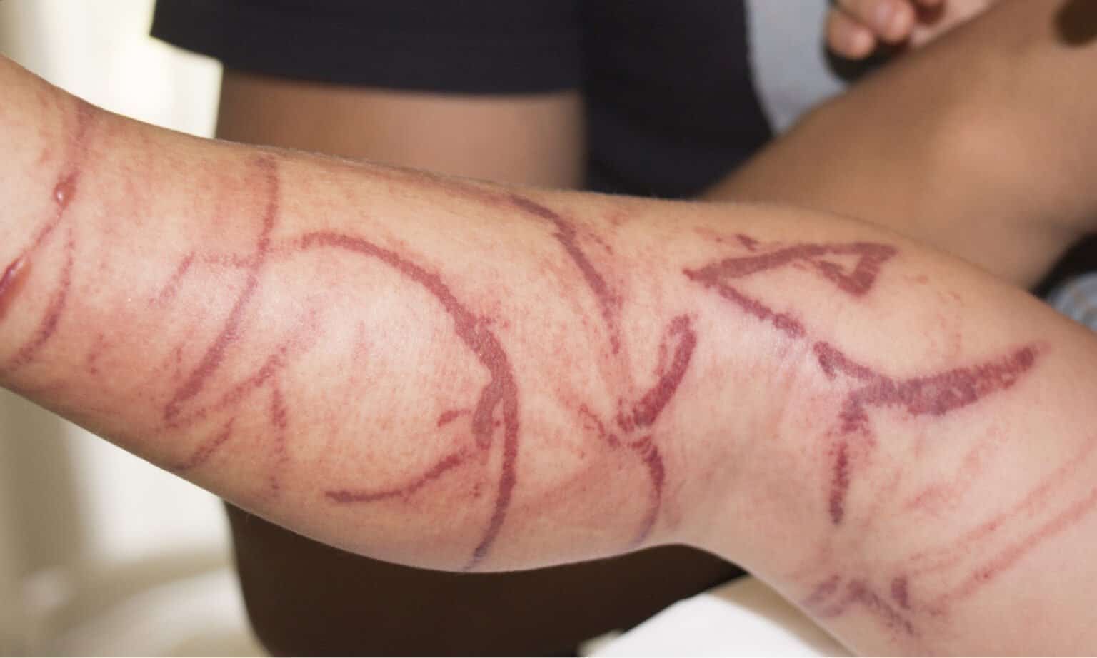 Inland Taipan vs Box Jellyfish Which Is More Deadly? AZ Animals