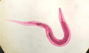 Are Pinworms Dangerous? - A-Z Animals