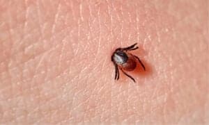 How to Check For Ticks photo