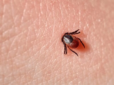 A How to Check For Ticks