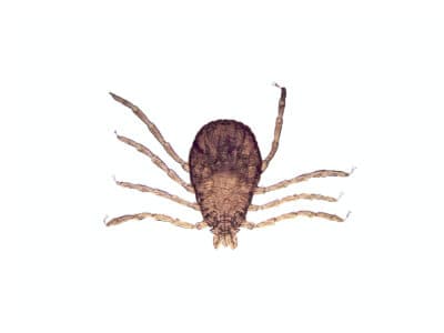 A How Many Legs Do Ticks Have (And Why?)