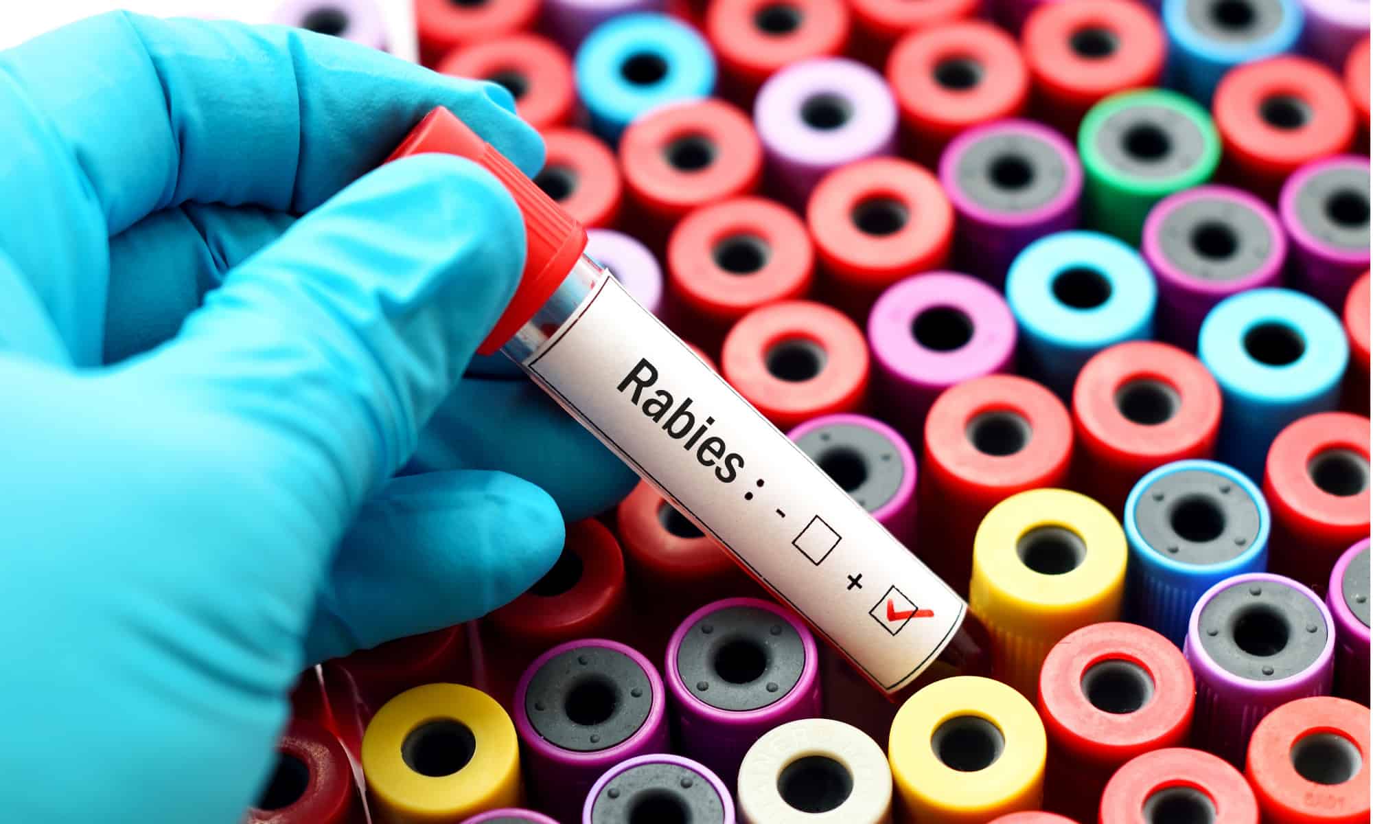 A gloved hand selecting a vial of rabies vaccine