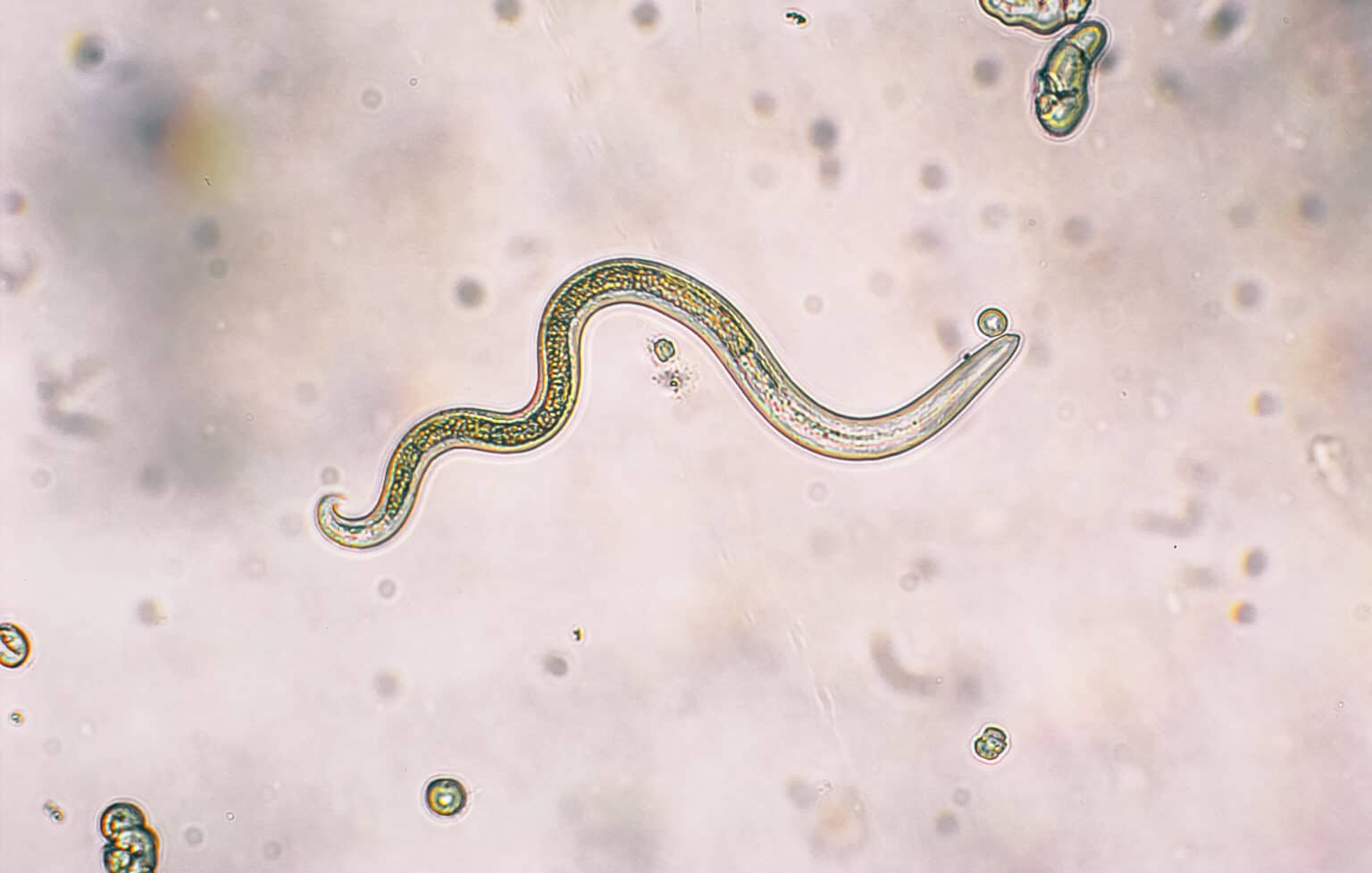 Can Humans Get Roundworms from Dogs? AZ Animals