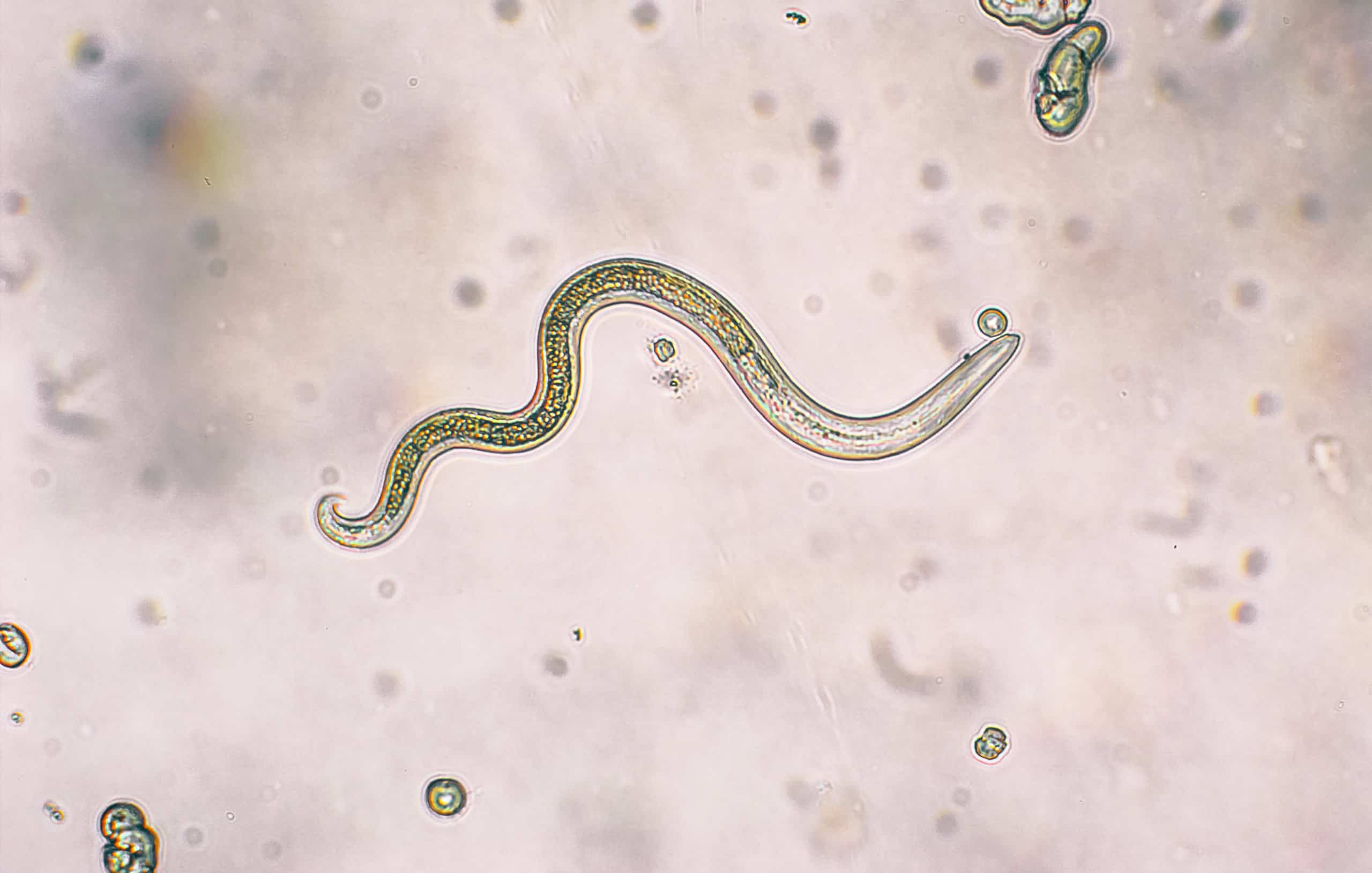 Toxocara canis (roundworm infection) second stage larvae hatch from eggs