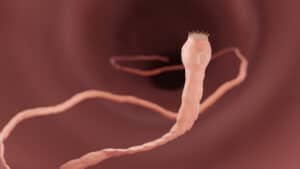 What Do Tapeworms Eat? photo