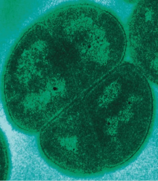 Deinococcus radiodurans "Lazarus microbe." 