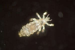 Are Lice Black? (+ Other Questions Answered) Picture