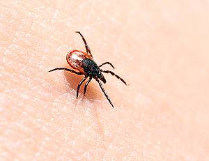 10 States Where Tick-Borne Lyme Disease Is a Big Issue Picture