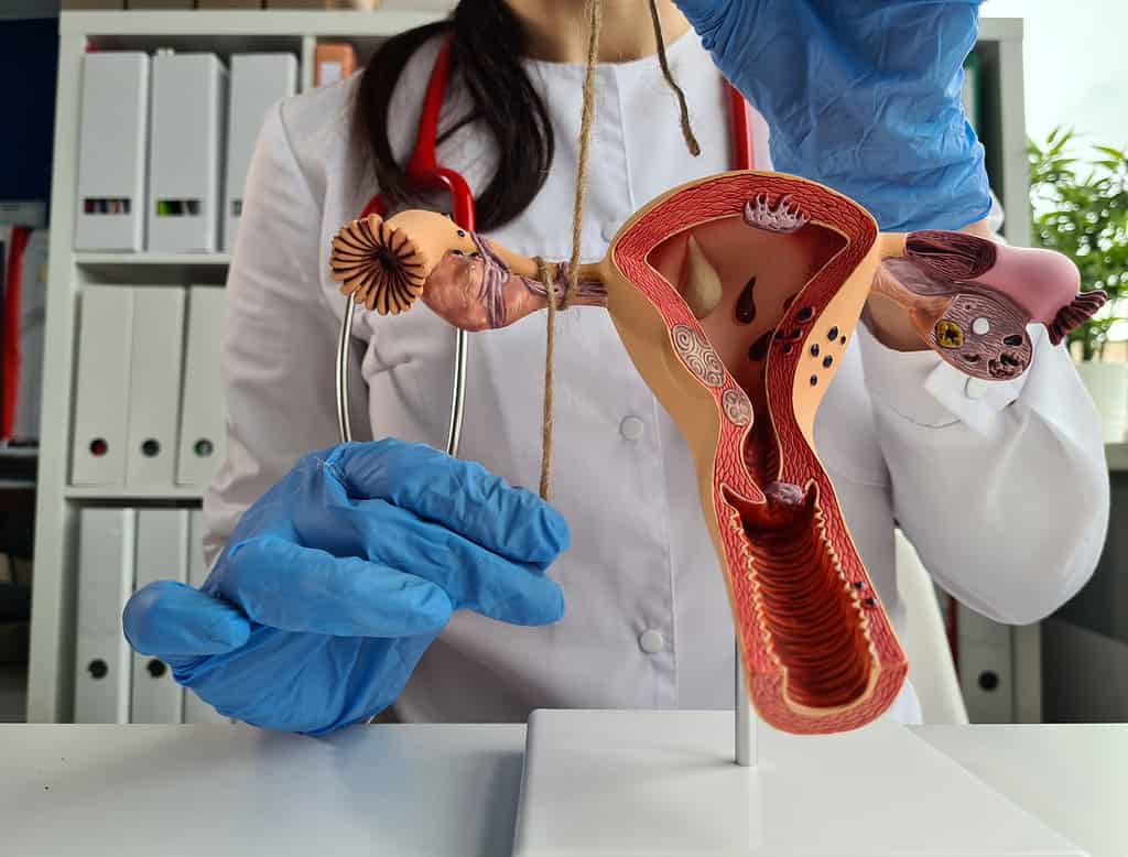 Doctor holding model of a human uterus