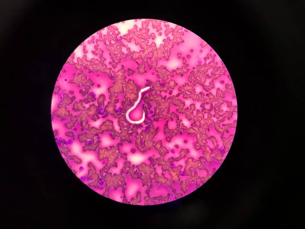 Dirofilaria immitis or heartworm in a petri dish of dog's blood.