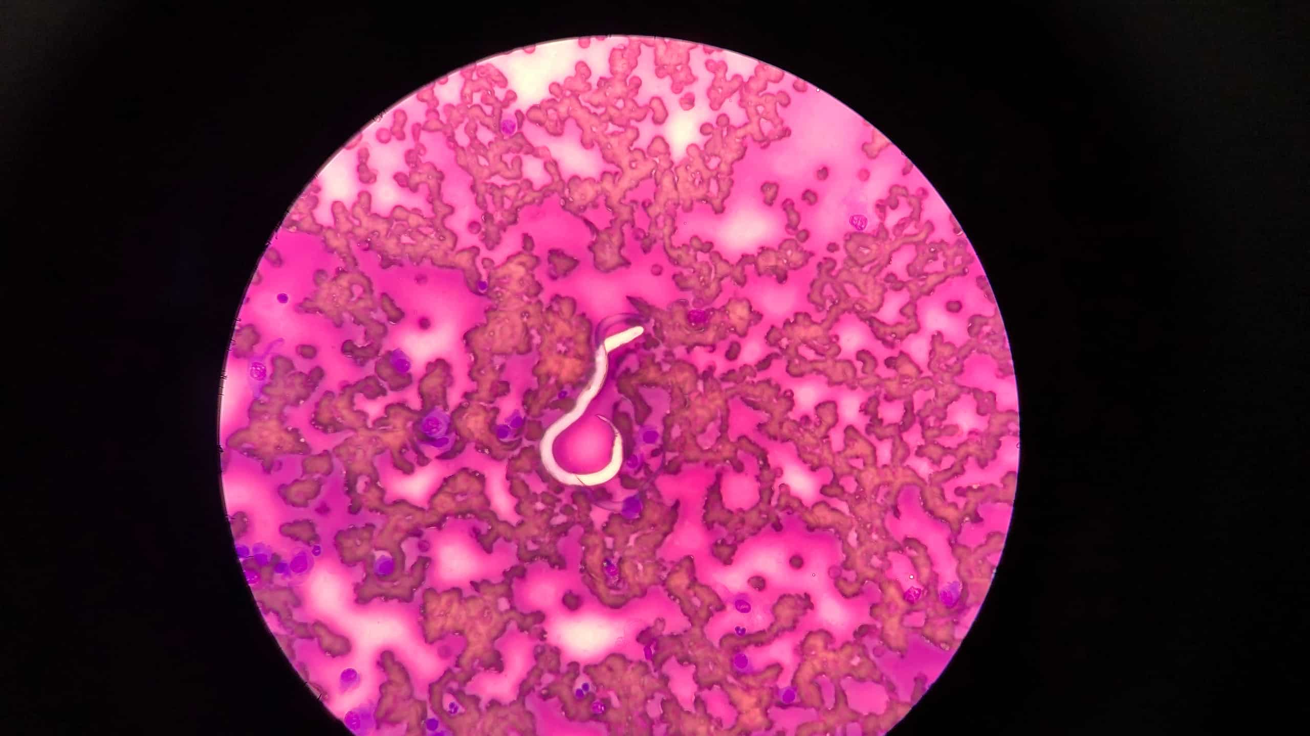 Dirofilaria immitis or heartworm in a petri dish of dog's blood.