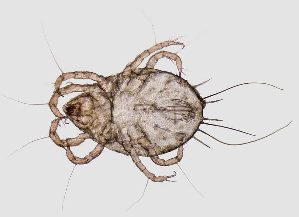 microscopic shot showing a house dust mite