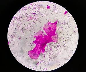 Gram Positive vs Gram Negative: Identifying Bacterial Species Through Staining Techniques Picture