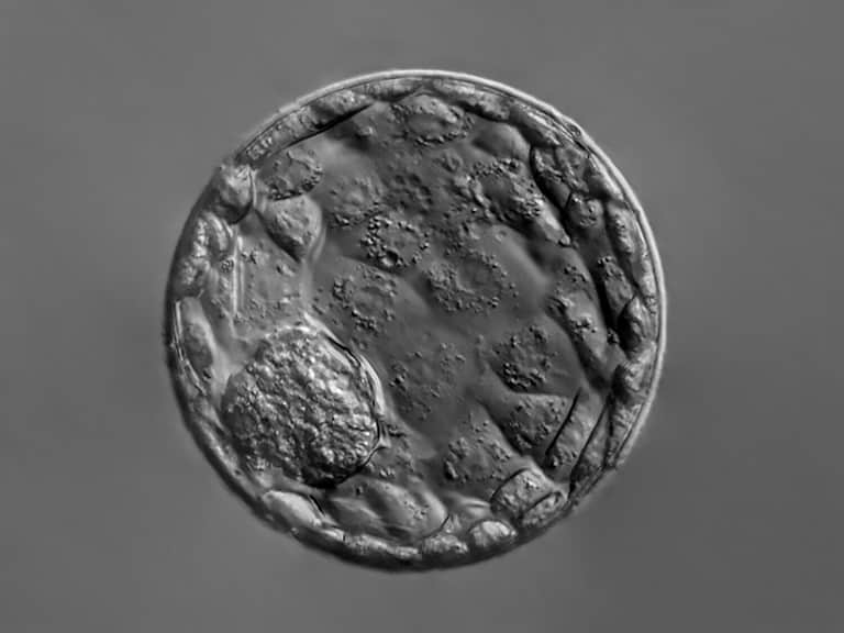 Photomicrograph of an isolated blastocyst stage human embryo, 20x magnification. Embryogenesis. Research. Genes. Life.
