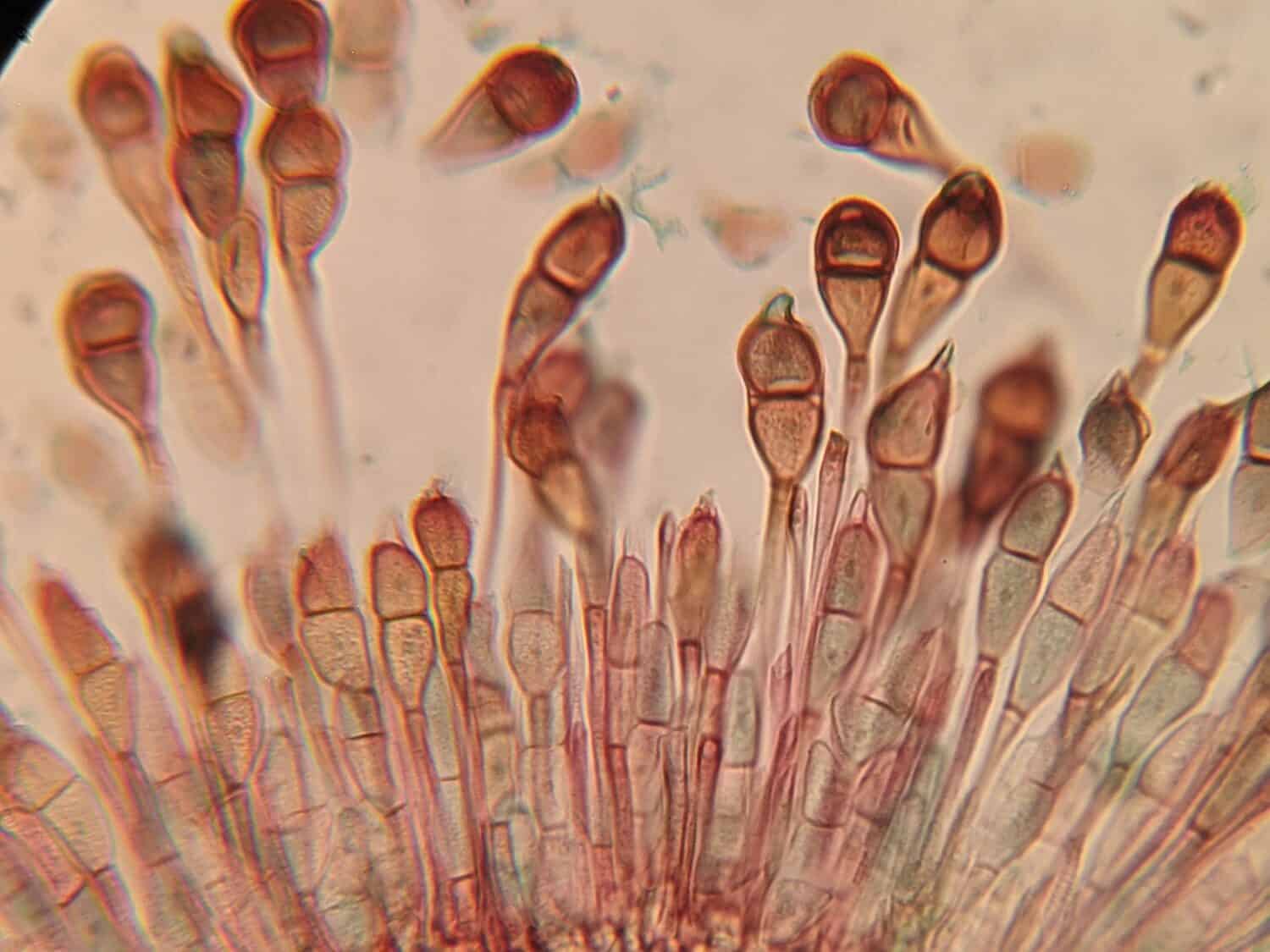 photo under microscope of fungi growth on the plant cells