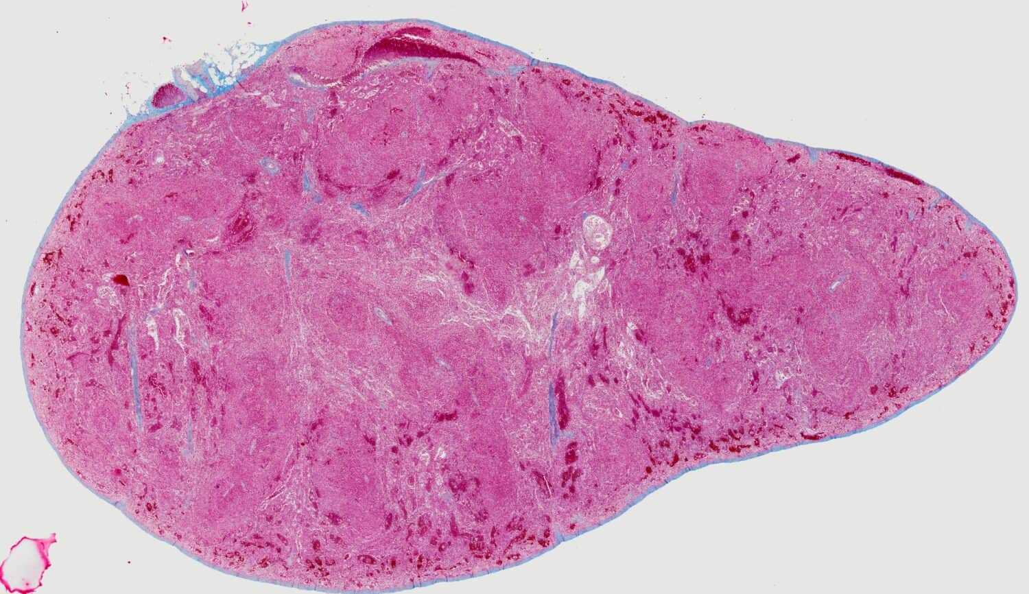 The spleen (shown here in cross-section with staining) is the largest organ in the lymphatic system.