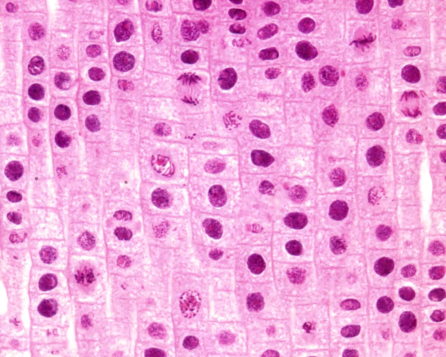 Light microscope micrograph showing mitosis in onion cells of the root meristem. Two examples of each prophase, metaphase and anaphase can be seen.