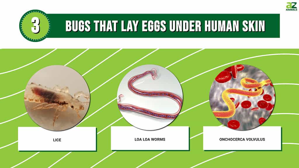 Picture graph of 3 Bugs That Lay Eggs Under Human Skin