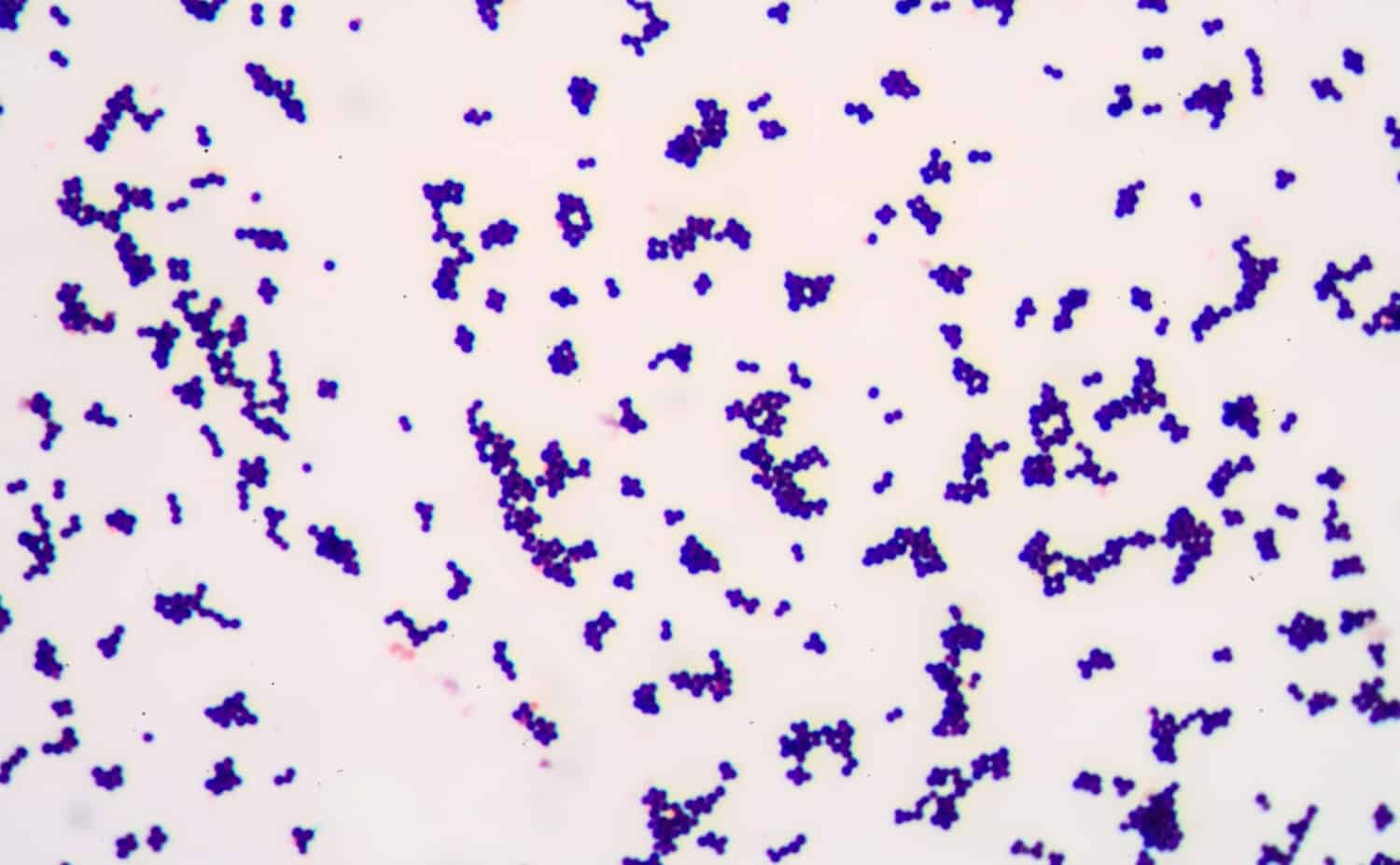 Gram staining reveals Gram-positive bacteria.