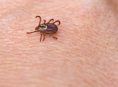 American Dog Tick (Dermacentor variabilis) on human skin.