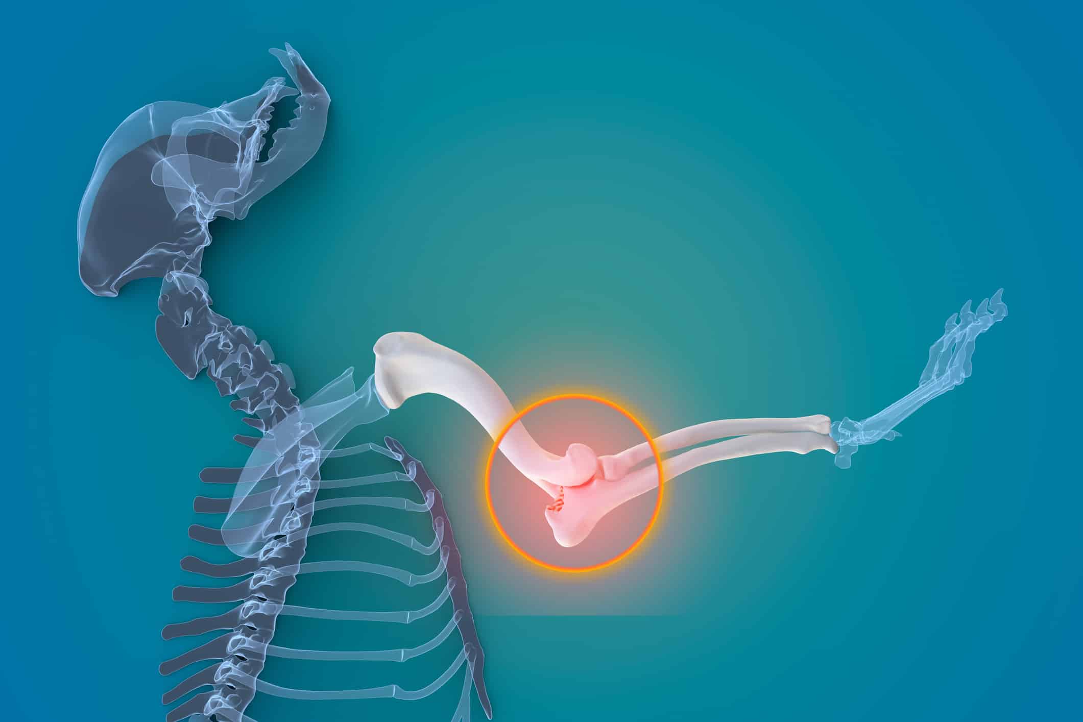 Canine Arthritis and Osteoarthritis joint inflammation