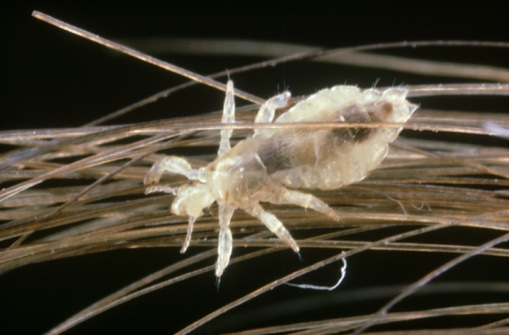 human head louse: pediculus humanus  on hair