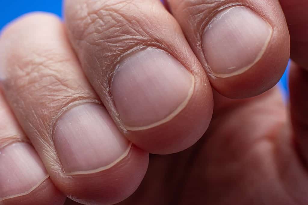 A fingernail is a skin appendage made of keratin.