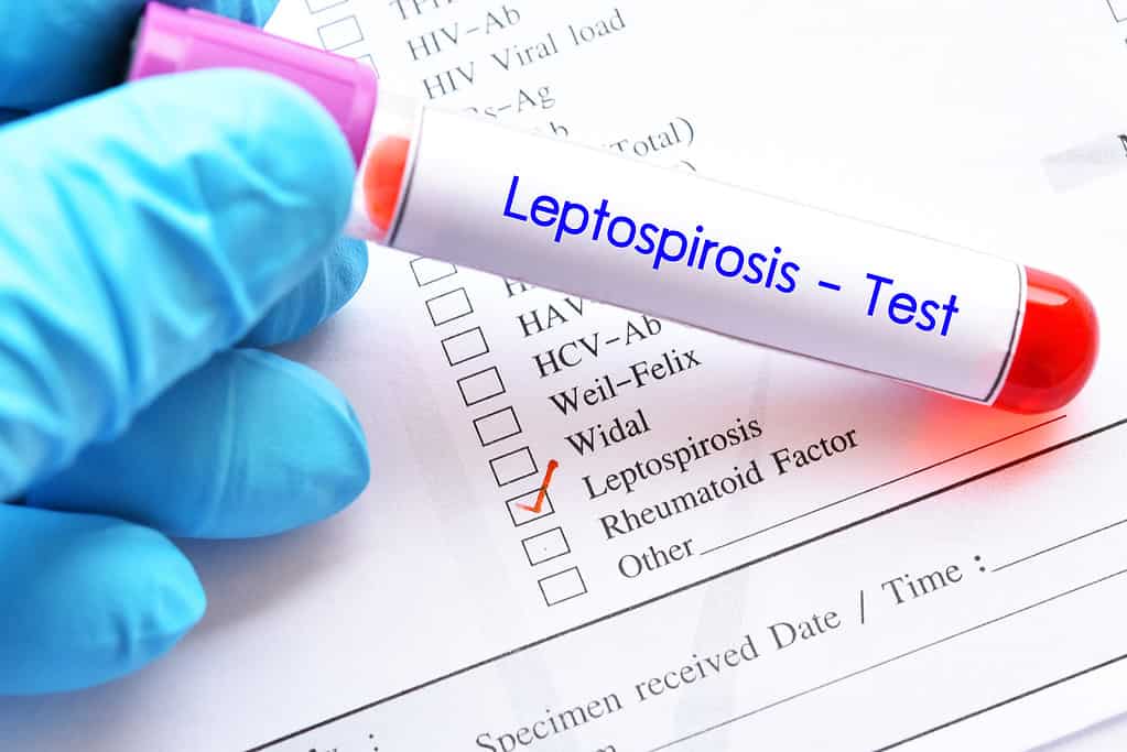 Blood sample tube for Leptospirosis test
