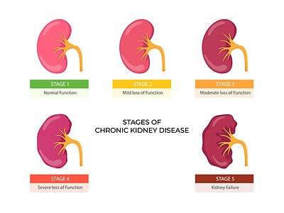Kidney Disease in Elderly Cats: Early Signs and Treatment - A-Z Animals - Indications Of Kidney Disease In Aged Cats