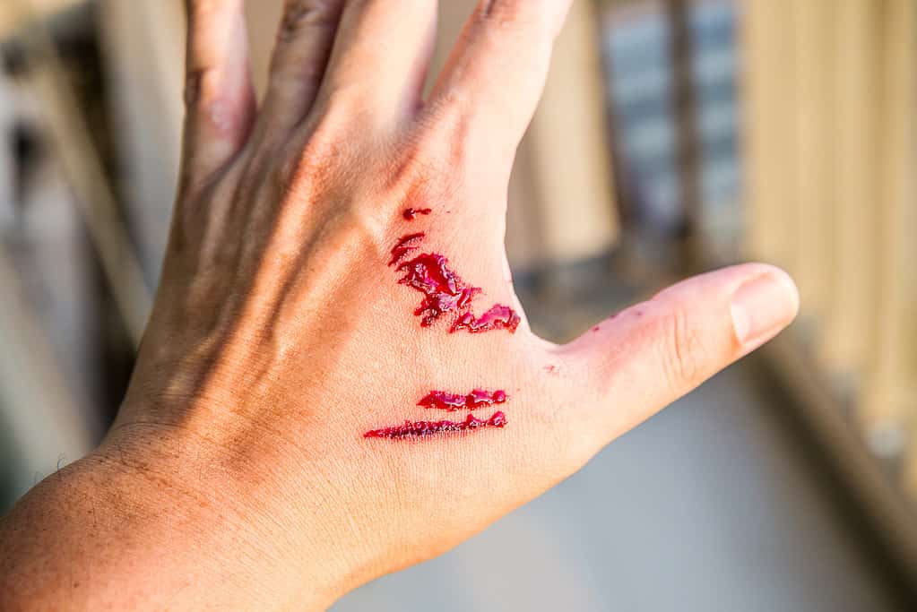 Focus dog bite wound and blood on hand. Infection and Rabies concept.
