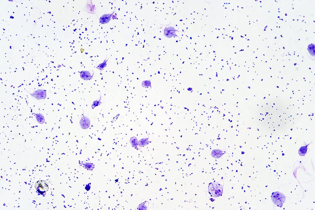 Flagellated protozoan parasite Giardia intestinalis under the microscope