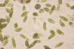 What Is Golden Algae? Is It Dangerous? Picture