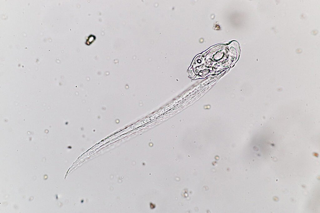 Larvacea (Marine Protozoa) under microscope
