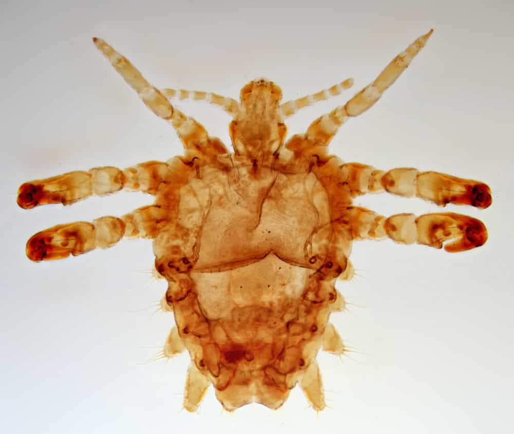 Pubic louse (Pthirus pubis) under microscope