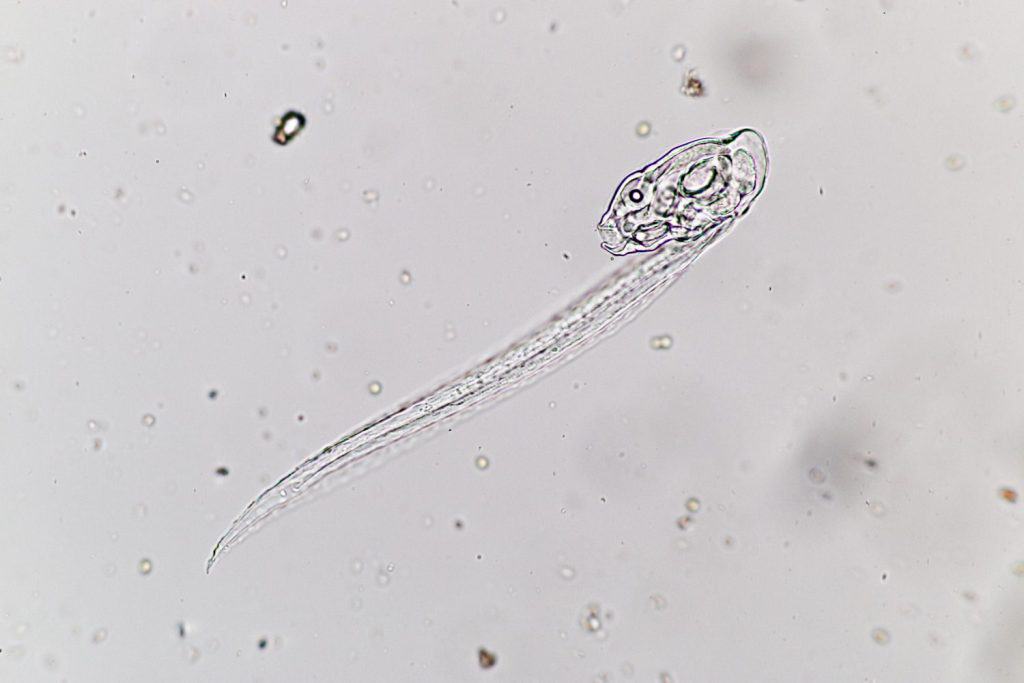 Larvacea (Marine Protozoa) under microscope