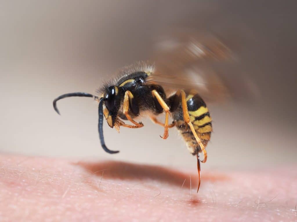 Wasp sting pulls out of human skin. macro