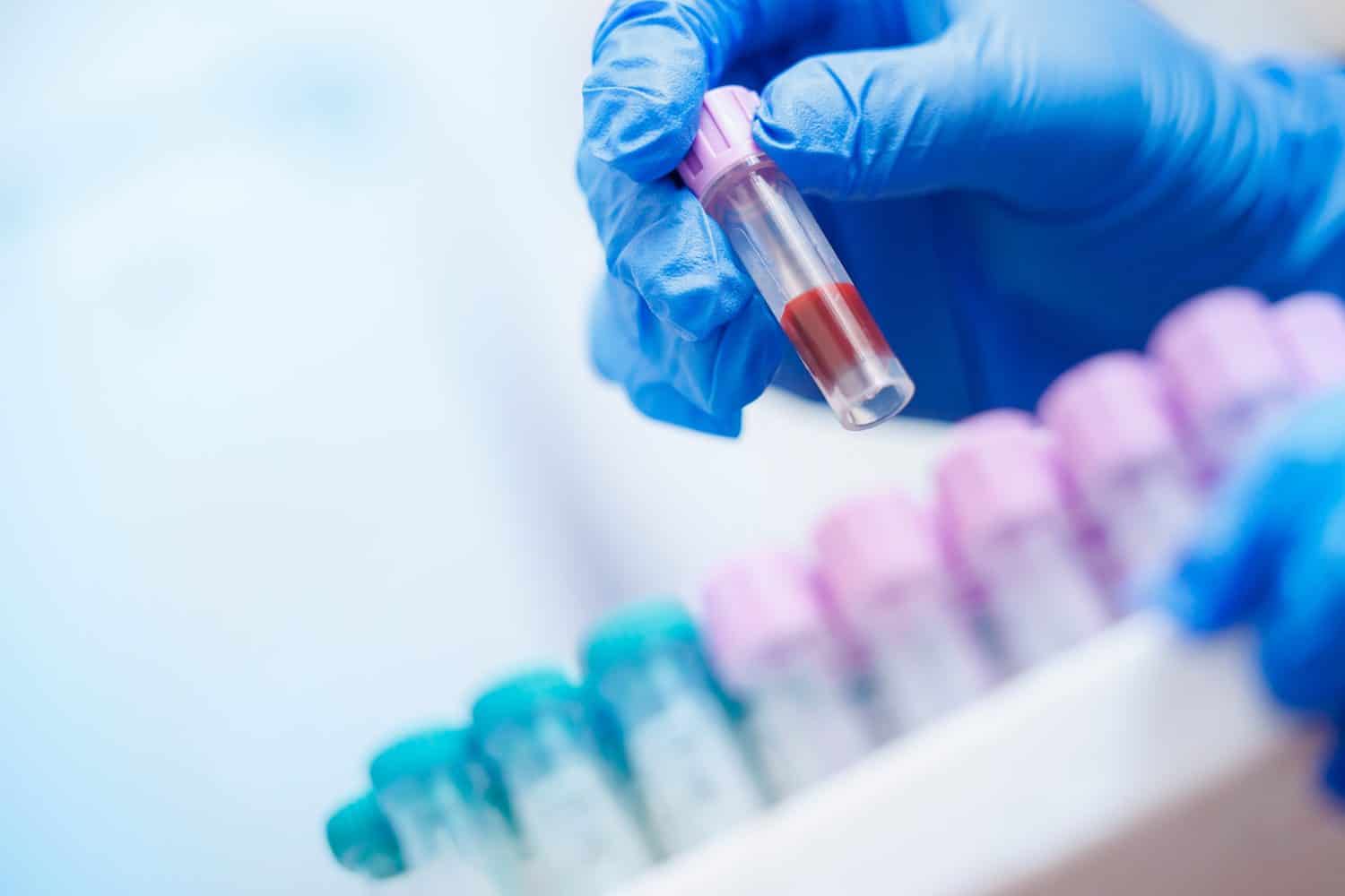 Gloved hands holding blood sample at veterinary clinic laboratory.