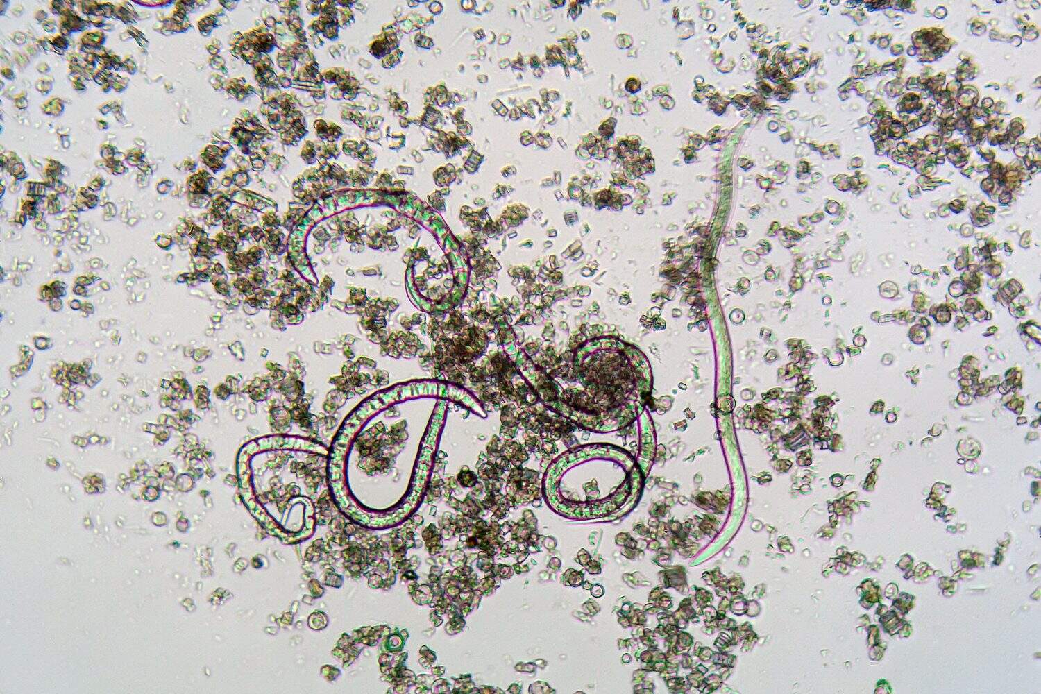 The nematode Steinernema feltiae under the microscope, the species used as a biopesticide to infect fungus gnats in agriculture and gardening. 