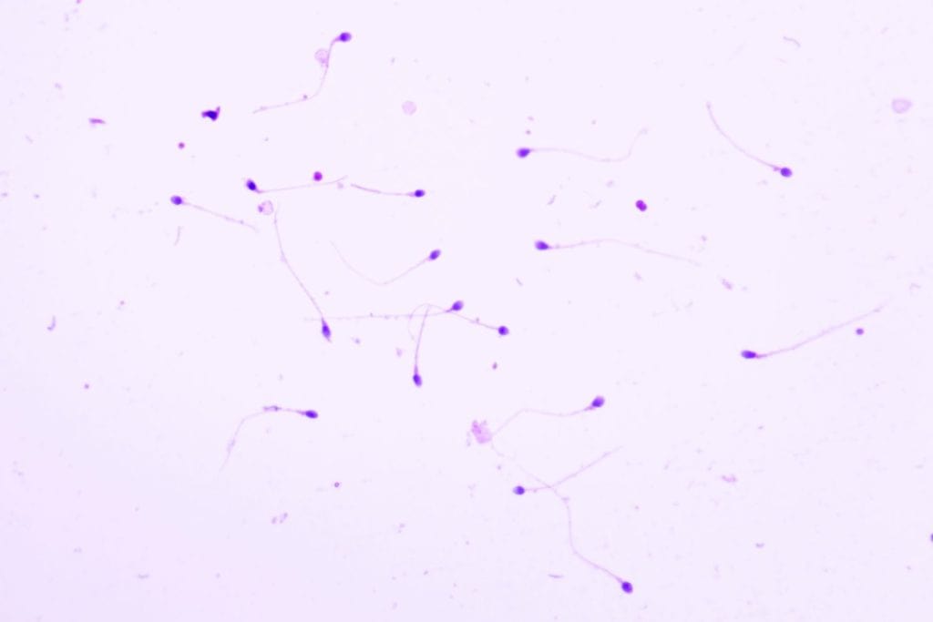 Human sperms viewed in the microscopic for male fertility test.Spermatozoa on white background.Reproductive system check.Donor suitability test for artificial insemination.Semen analysis.