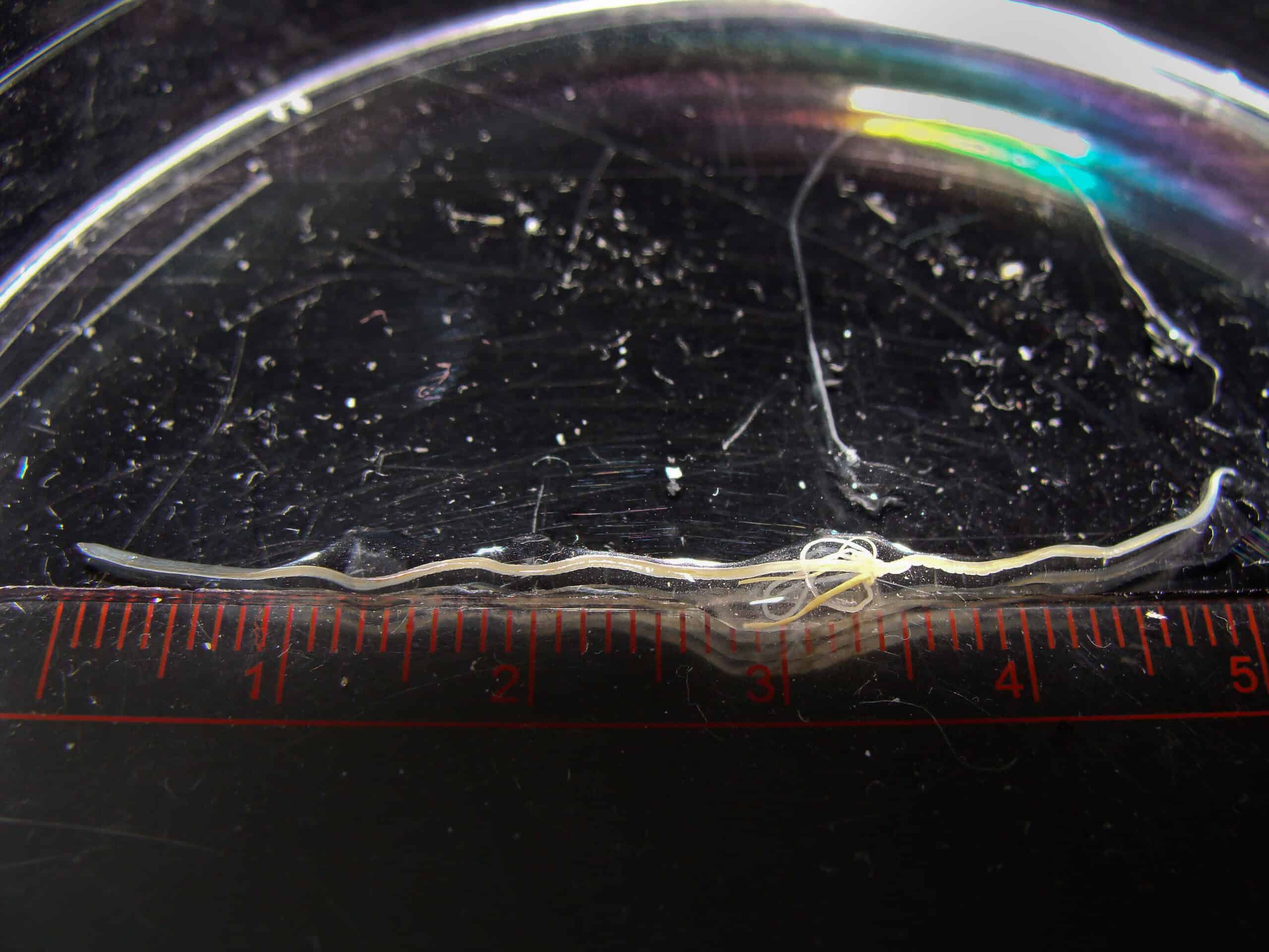 Loa Loa - filarial worm. This was extracted from a patient's conjunctiva in the left eye. It was still moving on extraction and measures 55mm in length by 0.5mm in width. Patient was originally from East Africa