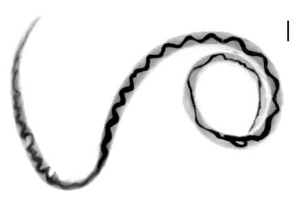 Angiostrongylus cantonensis, rat lungworm
